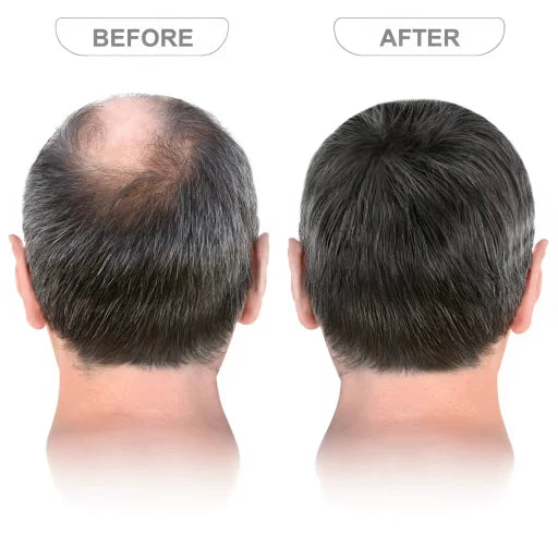 Nova Root - Hair Growth Serum